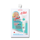 Anti Acne & Blemish Gel (8g)