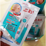 Clearance - Anti Acne & Blemish Gel (8g)